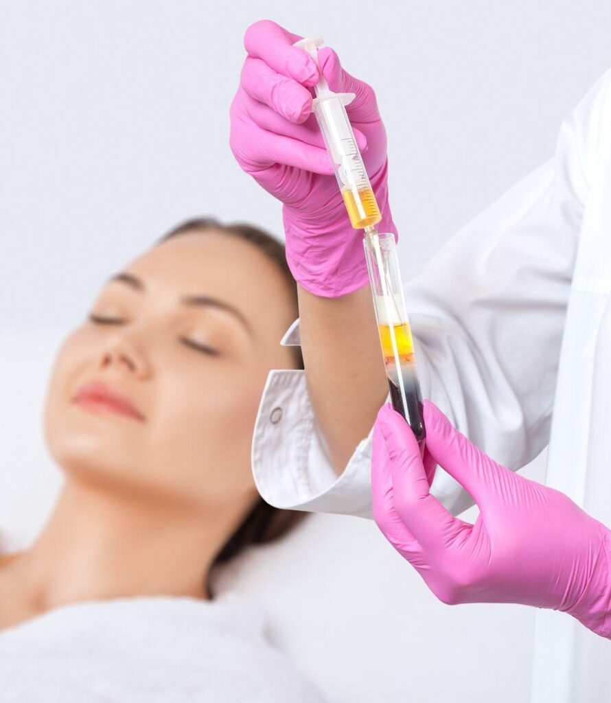Platelet-Rich Plasma Therapy (PRP)