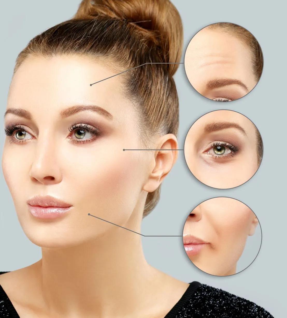 A woman 's face is shown before and after cosmetic procedures.