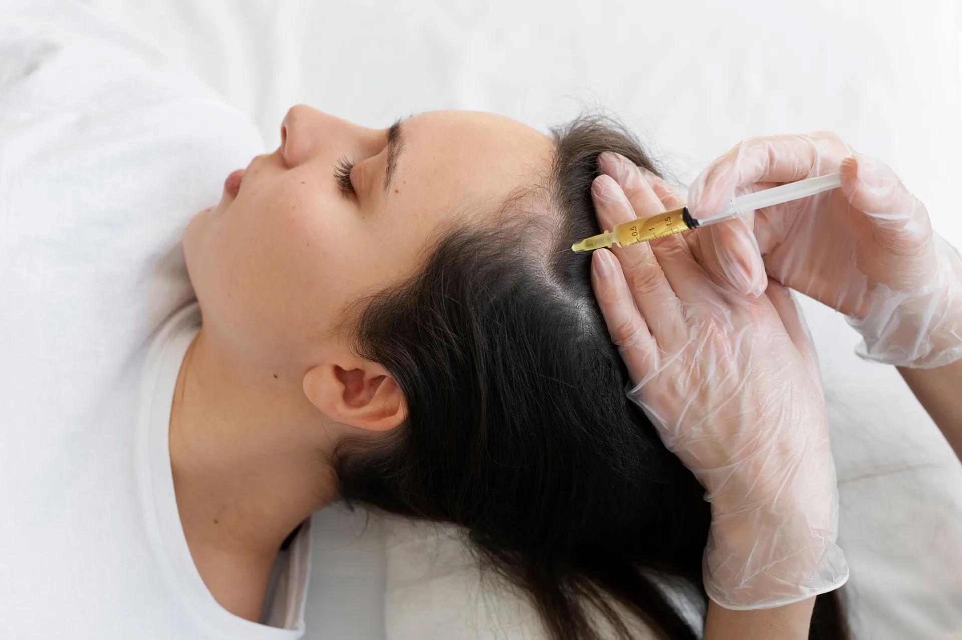 Woman receiving scalp injections with a syringe, lying down; treatment for hair loss.