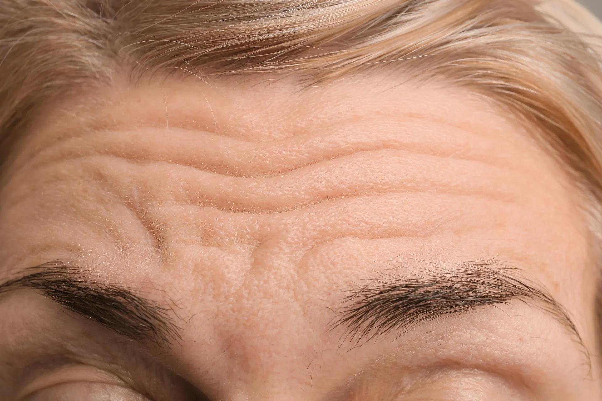 A close up of a woman 's forehead with wrinkles and eyebrows.