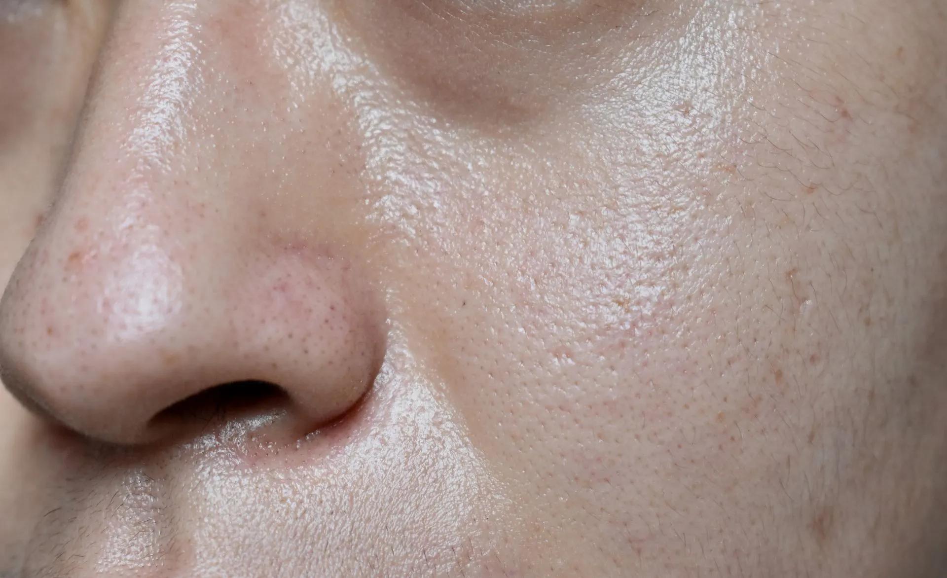A close up of a woman 's face and nose.